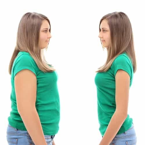 Is Gastric Sleeve Surgery in Mexicali Safe? What You Need to Know